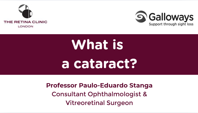 What is a cataract? With Professor Paulo Eduardo Stanga